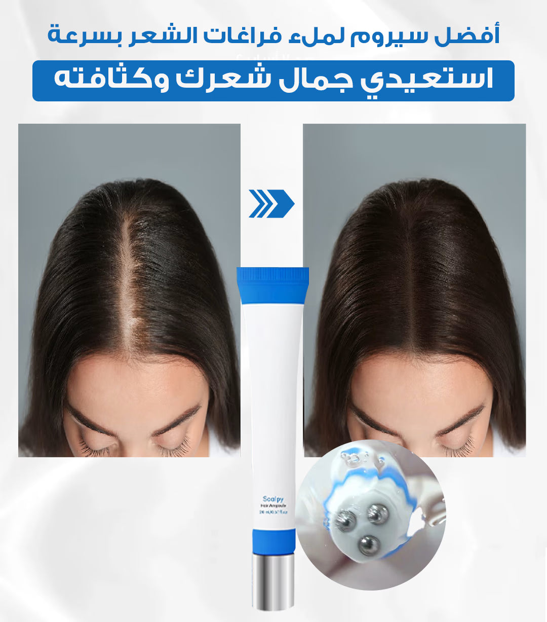 سيروم لنمو الشعر لفروة الرأس وعلاج تساقطه وترققه علامة SCALPY